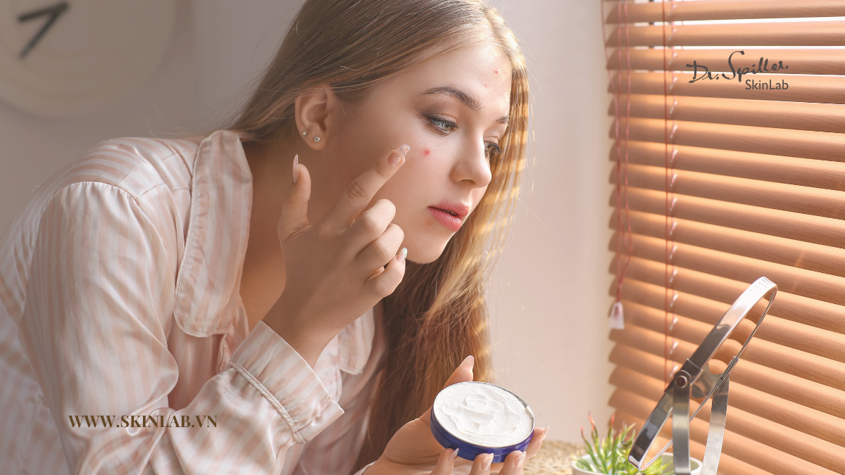 Phương pháp hỗ trợ điều trị mụn cho da nhạy cảm