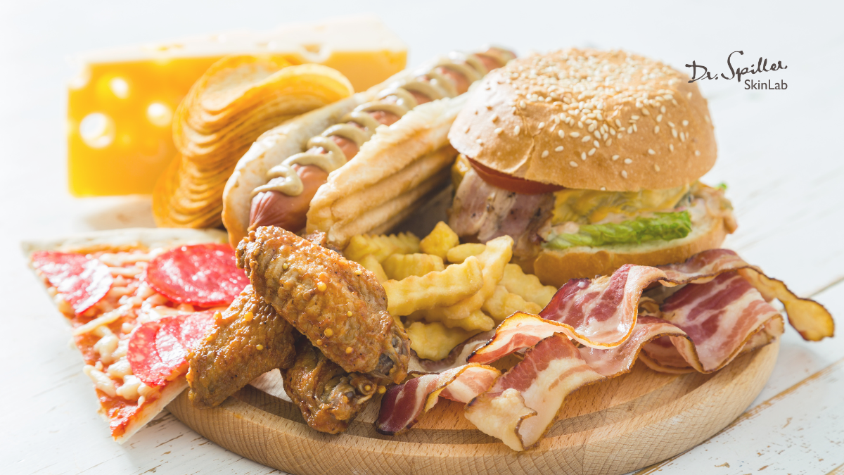 Da nhạy cảm nên kiêng thức ăn chứa nhiều chất béo bão hòa