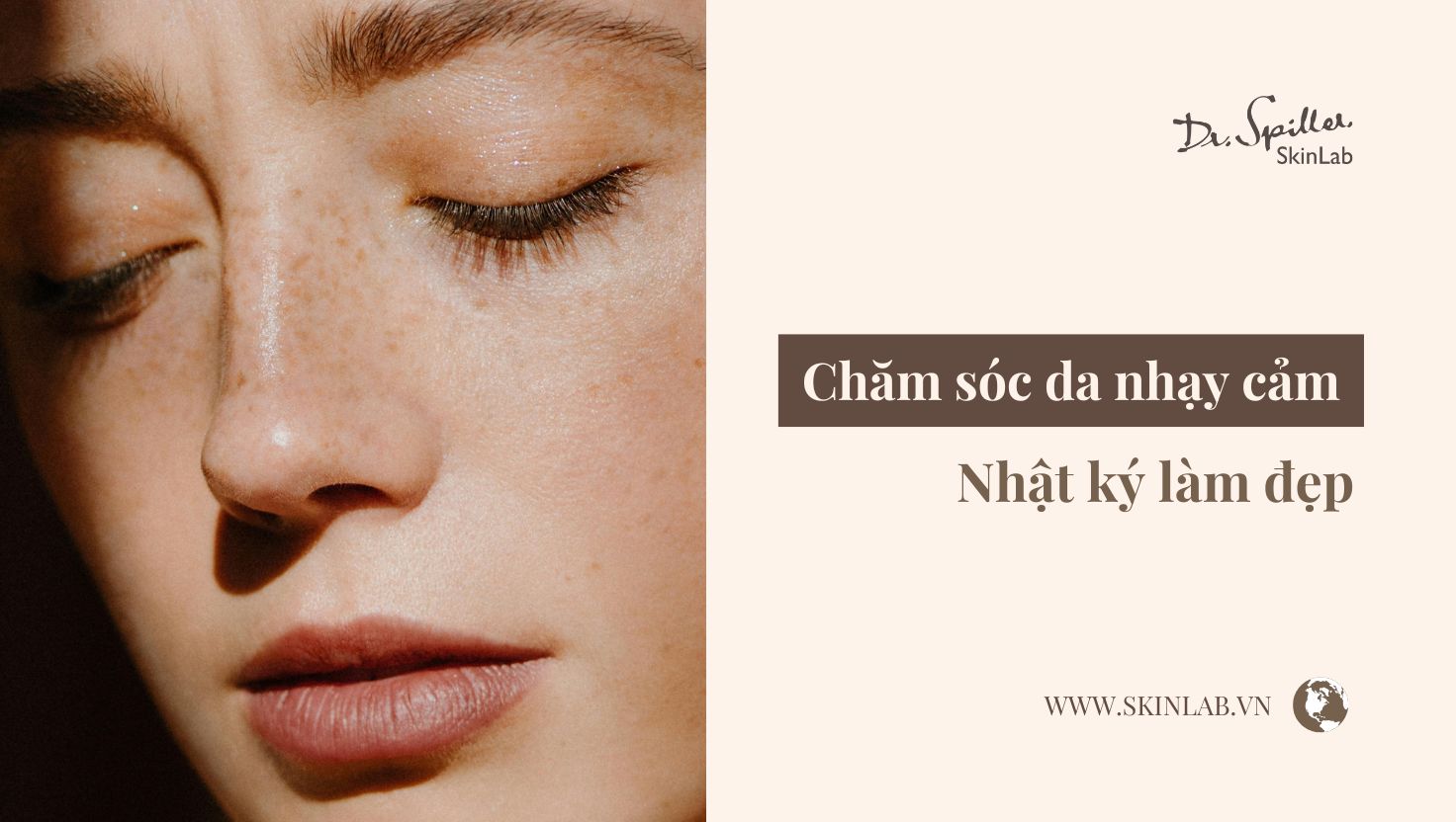 da nhạy cảm mùa hè