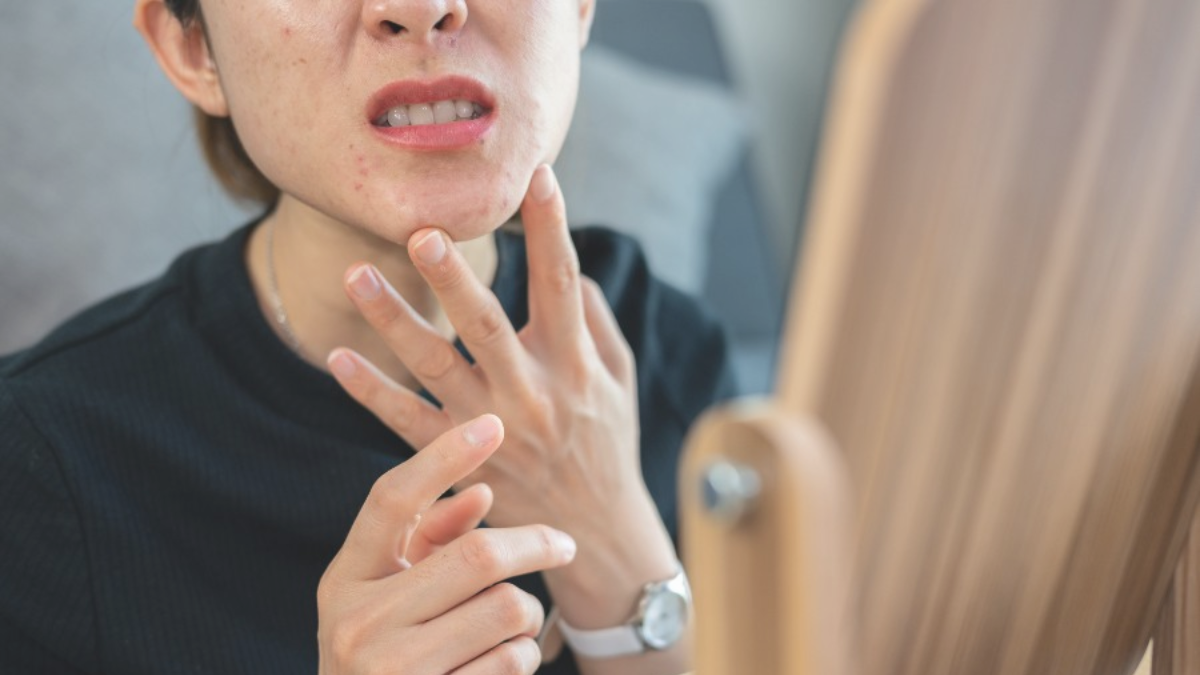 Da nhạy cảm ngứa rát - Hiểu và chăm sóc đúng cách từ chuyên gia