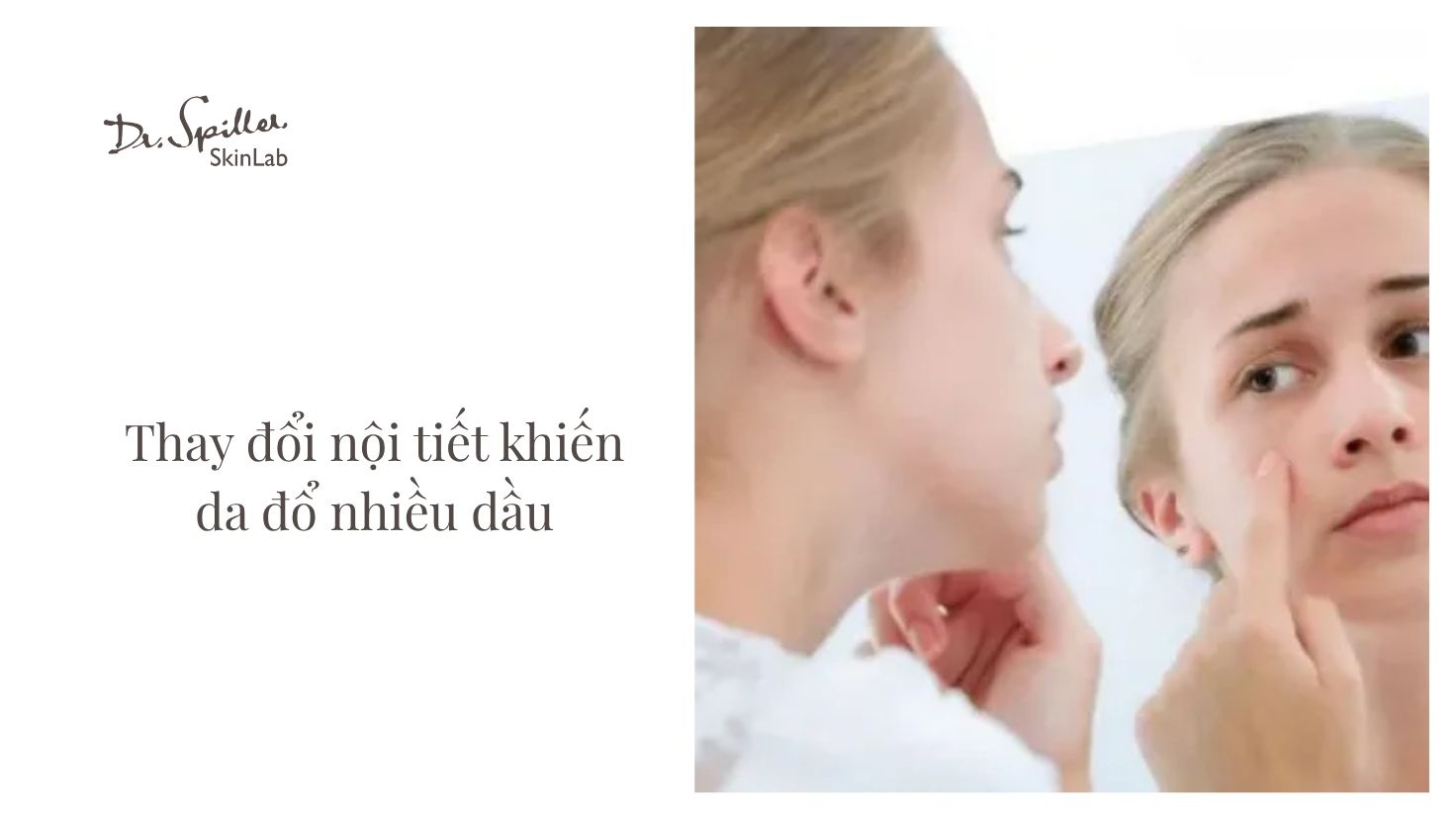 Nguyên nhân dẫn đến tình trạng đổ dầu nhiều trên da mặt