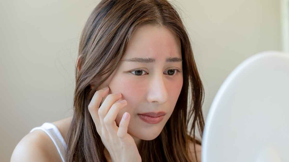 Đặc điểm của làn da nhạy cảm cần hiểu rõ