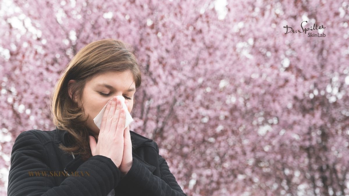 Vì sao da nhạy cảm dễ bị “khủng hoảng” vào mùa xuân?