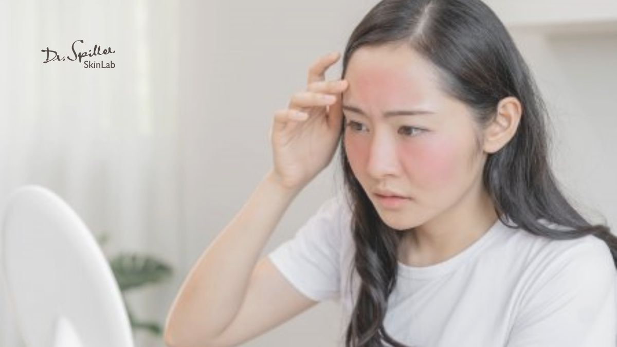 Tác động của ánh nắng mặt trời đến da nhạy cảm