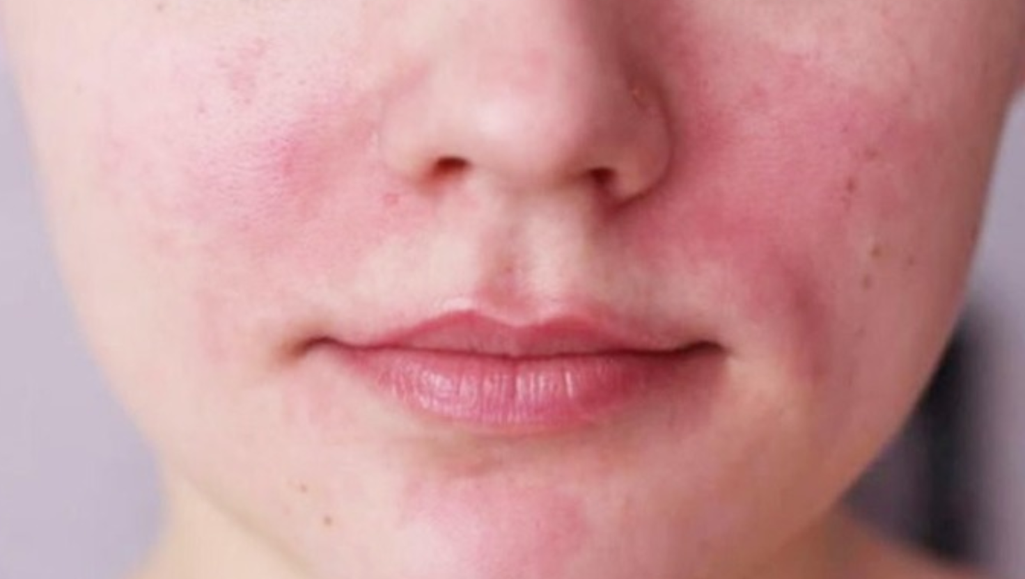 Da nhạy cảm là gì?