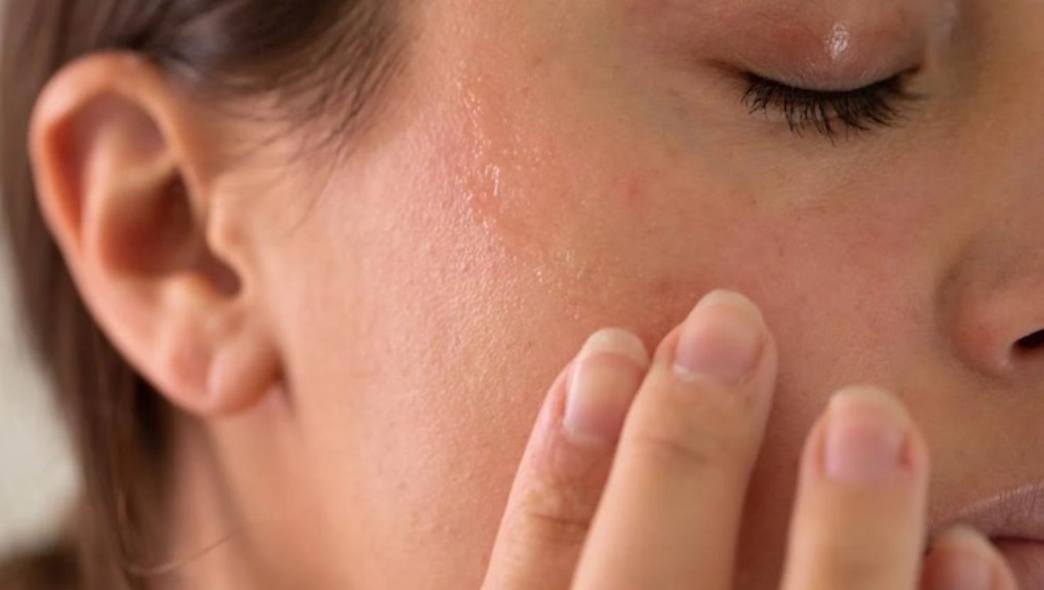 Nhận biết sớm những dấu hiệu này giúp bạn điều chỉnh chế độ chăm sóc kịp thời, tránh da bị tổn thương nghiêm trọng hơn.