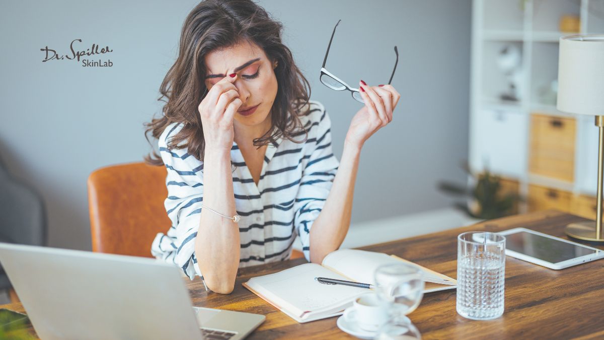 Stress, mất ngủ, thay đổi nội tiết tố khiến da nhạy cảm, suy yếu hàng rào bảo vệ da