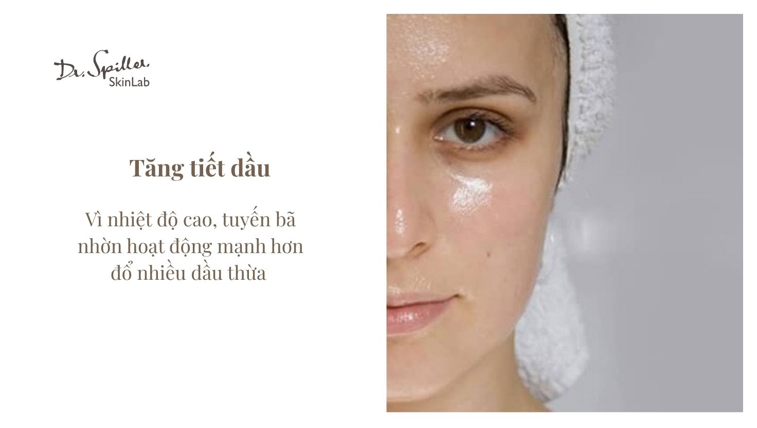 Những đặc điểm quan trọng khi skincare mùa hè