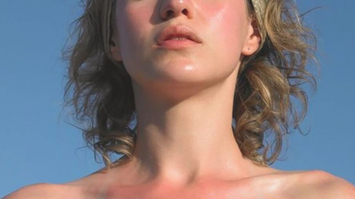 Nền nhiệt mùa hè ngày càng cao khiến việc chăm da nhạy cảm càng cần được coi trọng