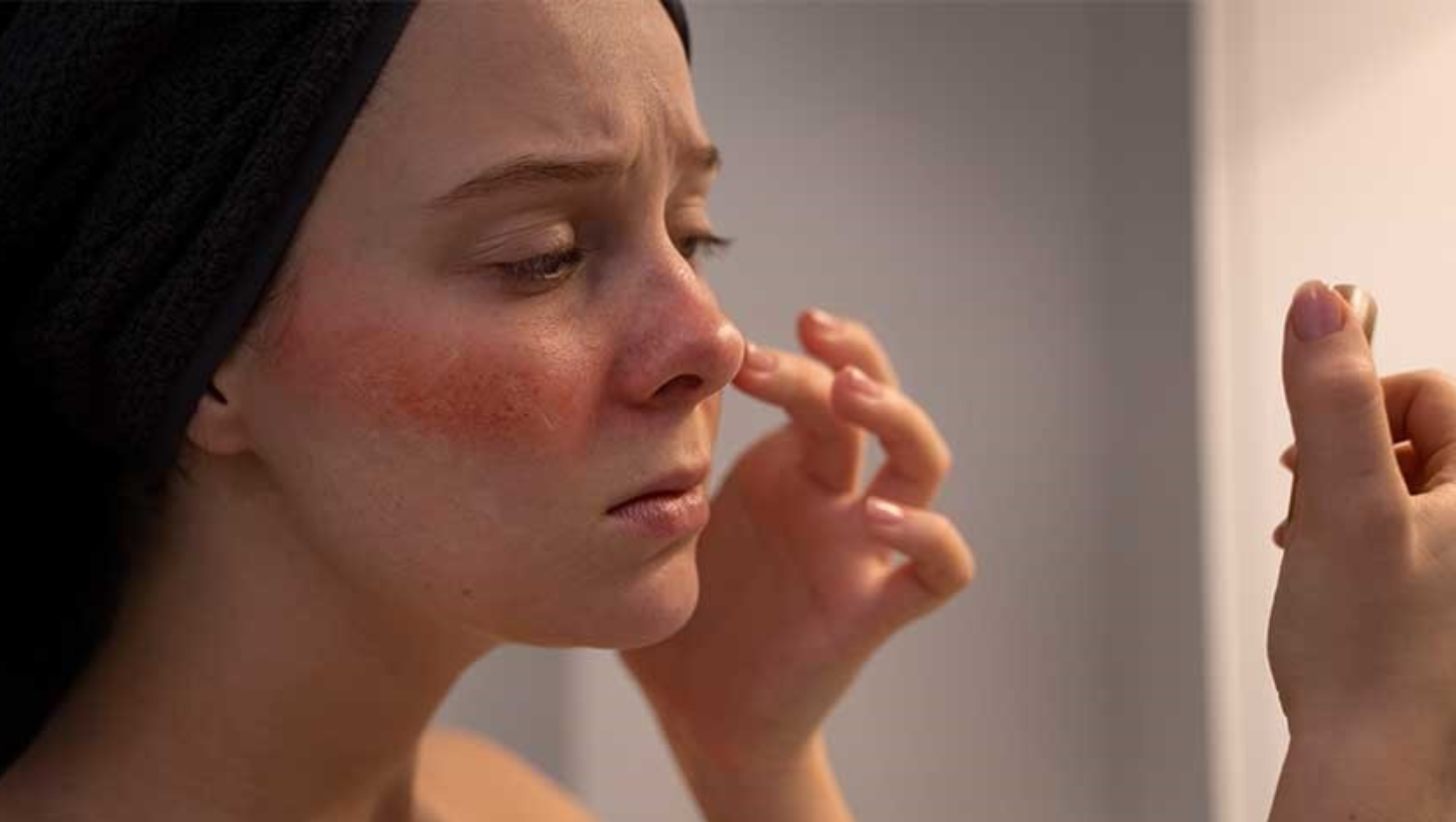 Da nhạy cảm là gì?