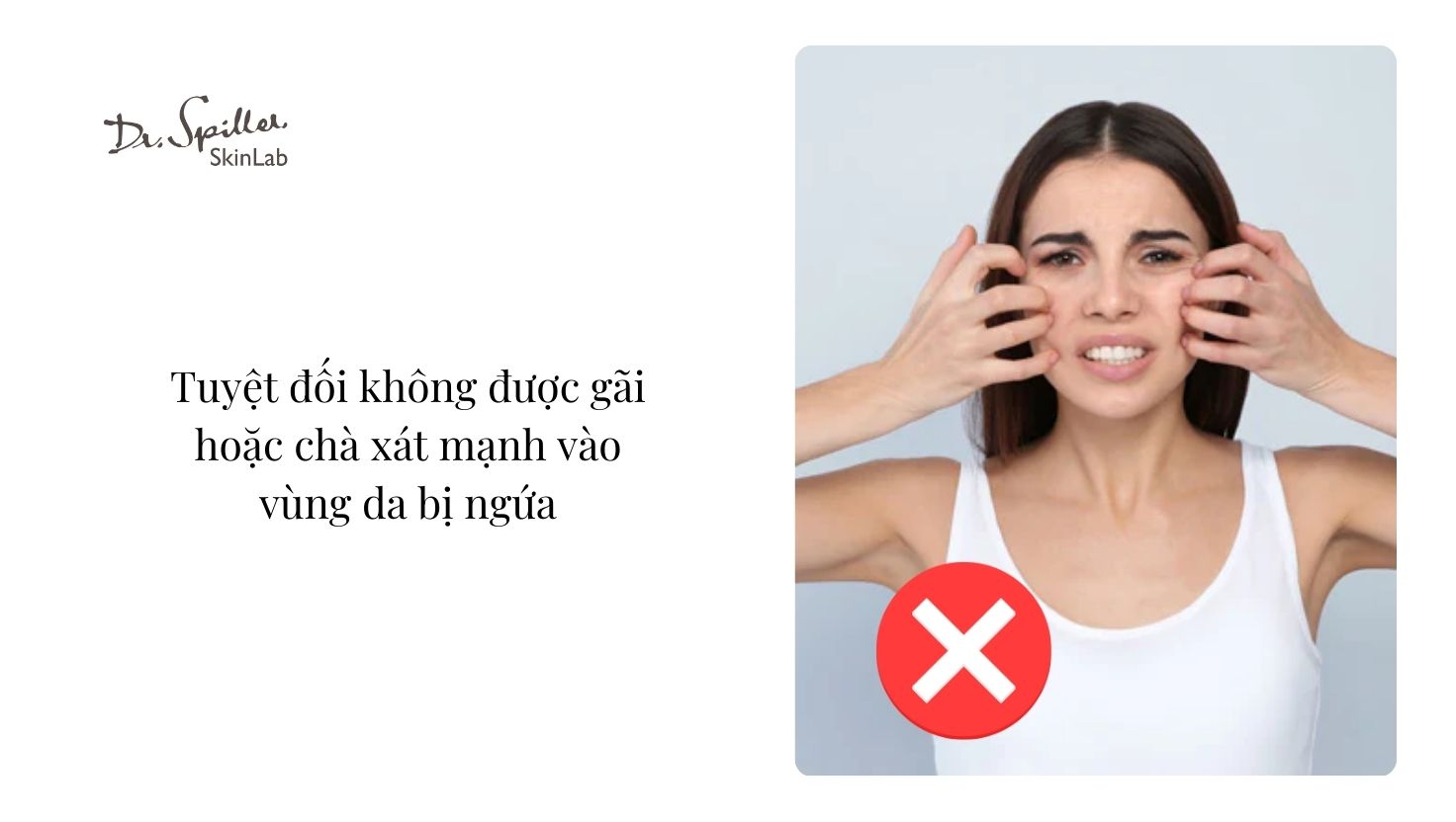 Tránh các yếu tố gây kích ứng