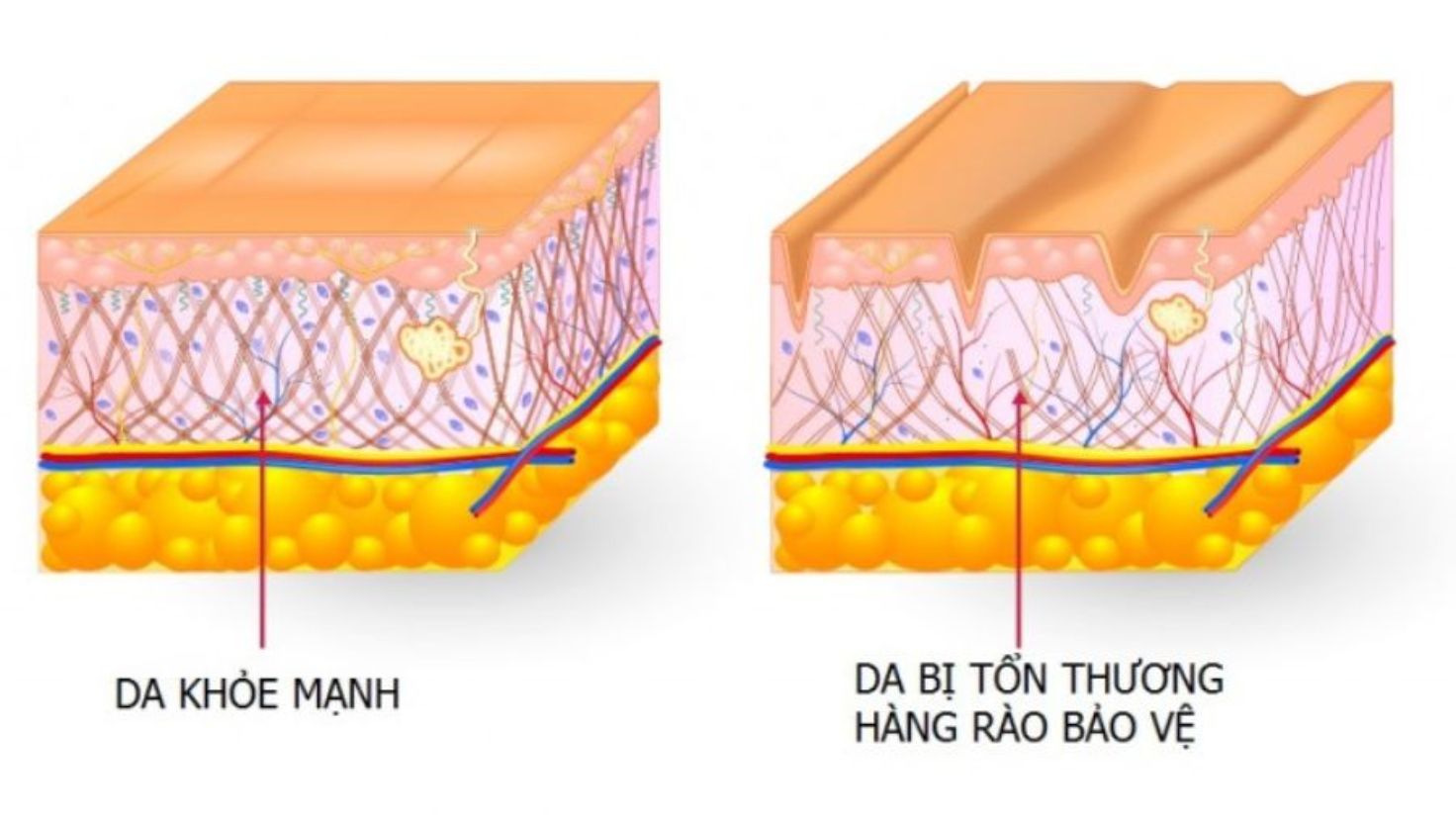 Các dấu hiệu cho thấy hàng rào bảo vệ đang tổn thương