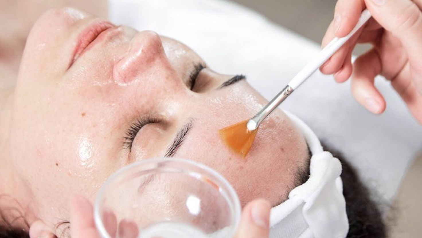 Có nhiều loại peel khác nhau. Peel nông giúp làm sáng da và trị mụn nhẹ