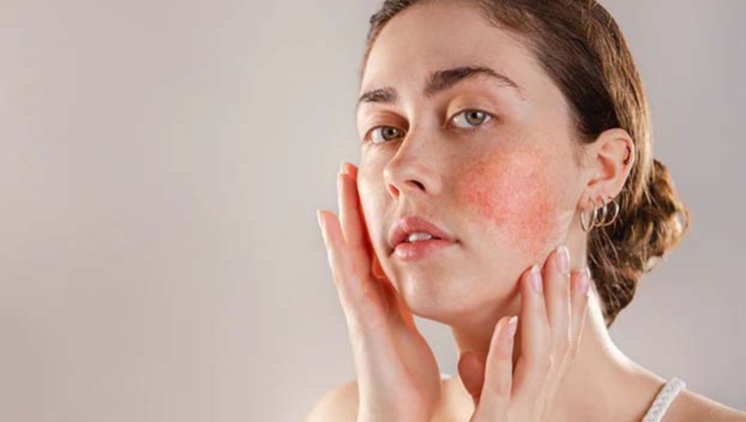 Sau treatment vấn đề như đỏ, sưng, và ngứa có thể xuất hiện