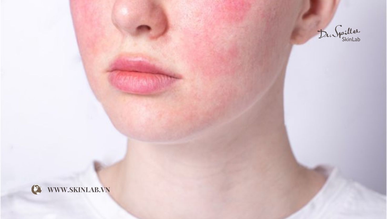 Xu hướng chăm sóc da sau treatment