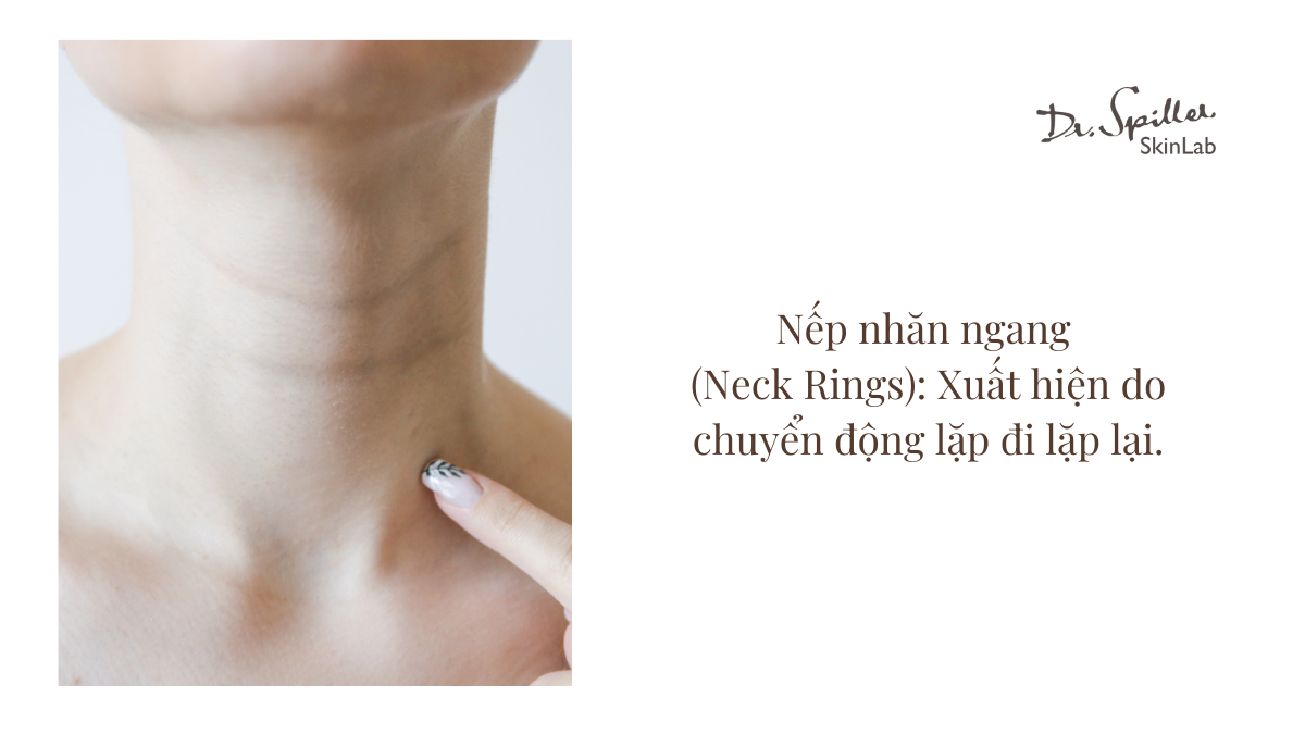 Các vấn đề da vùng cổ thường gặp