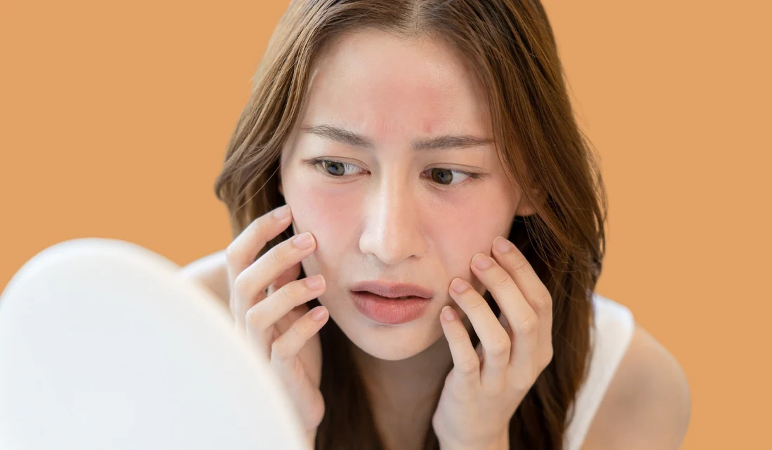 Tìm hiểu về cách giữ da không bị ngứa mùa lạnh giúp duy trì làn da luôn mềm mại, khỏe mạnh và chống lại mọi tác động xấu từ thời tiết khắc nghiệt.