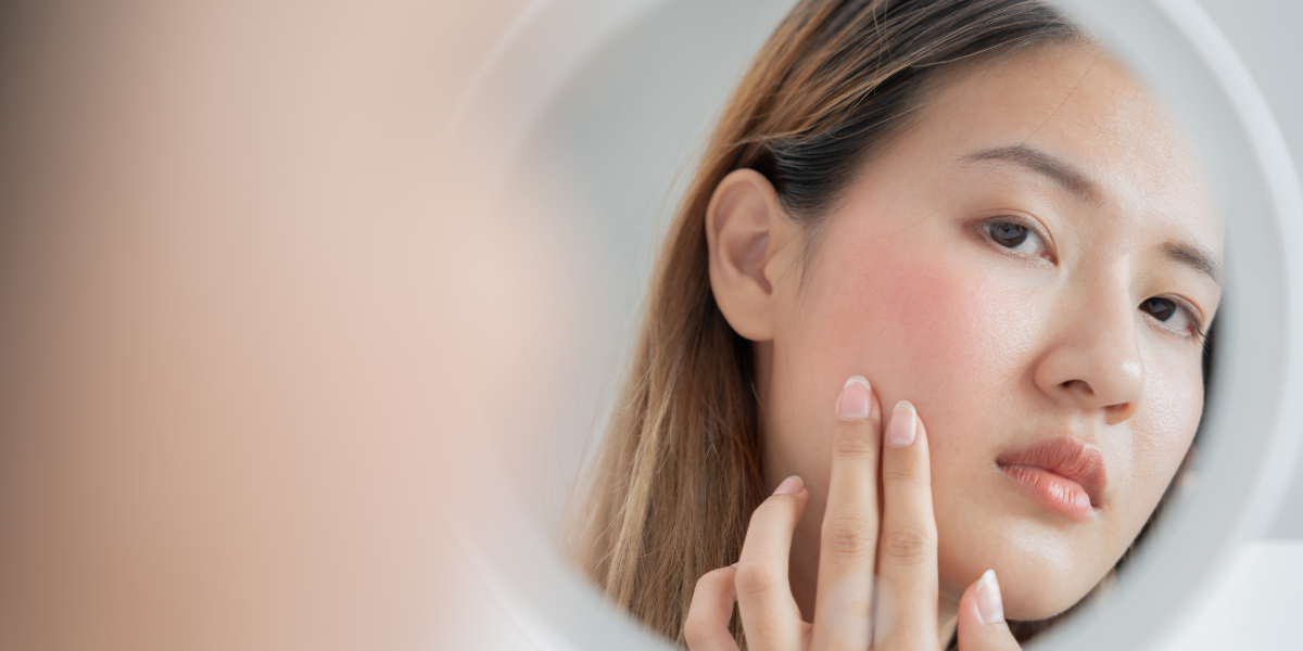 Biết cách phục hồi da nhạy cảm khi thời tiết thay đổi là rất quan trọng để duy trì vẻ đẹp và sự khỏe mạnh cho làn da