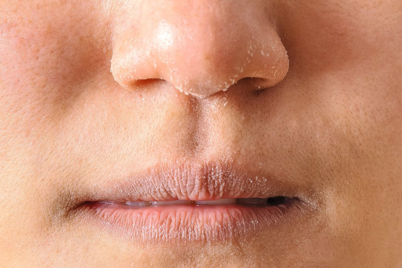 Chăm sóc da vào mùa hanh khô cần được ưu tiên hàng đầu để giữ cho làn da luôn khỏe mạnh và đầy sức sống.