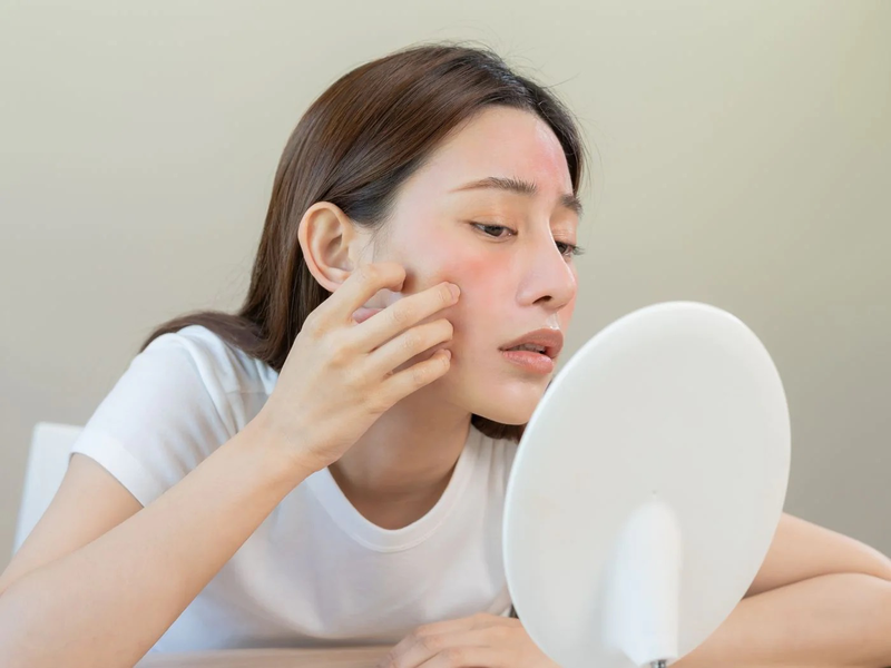 Bằng việc áp dụng các liệu pháp dưỡng ẩm đúng cách và lựa chọn sản phẩm phù hợp