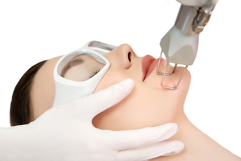 Điều trị tàn nhang bằng laser CO2 Fractional đem lại nhiều lợi ích so với các cách làm đẹp truyền thống khác.
