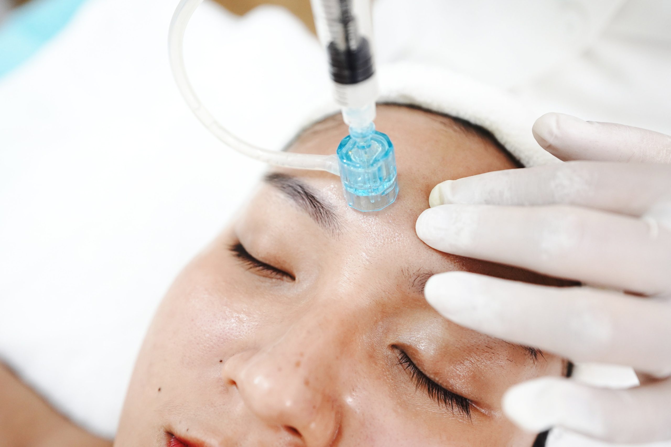 Liệu trình cấy collagen tươi phục hồi da chảy xệ hiện được đánh giá là giải pháp tiên tiến giúp lấy lại vẻ săn chắc và đàn hồi