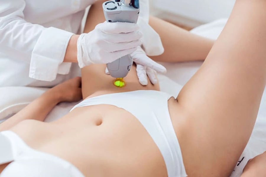 Triệt lông vùng bikini an toàn và không kích ứng là vấn đề quan trọng bởi vùng da này rất nhạy cảm