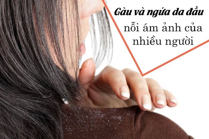 bạn không nên bỏ qua vai trò của việc duy trì thói quen chăm sóc và vệ sinh da đầu đúng cách tại nhà