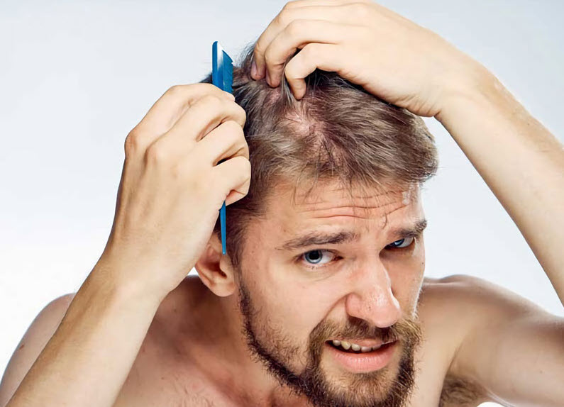 chăm sóc tóc cho nam giới rụng tóc là bước quan trọng giúp bảo vệ và phục hồi mái tóc khỏe mạnh theo thời gian