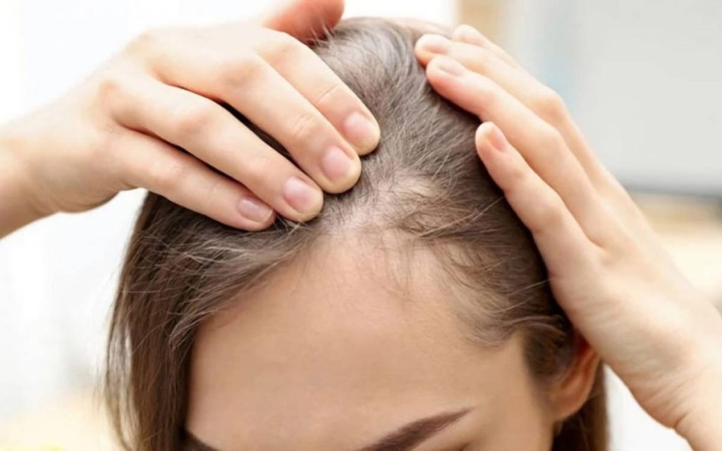 Bài viết này sẽ giúp bạn hiểu rõ hơn về cách chăm sóc đặc biệt dành cho tóc mỏng yếu nhằm đem lại kết quả tốt nhất