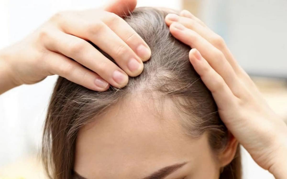 Bài viết này sẽ giúp bạn hiểu rõ hơn về cách chăm sóc đặc biệt dành cho tóc mỏng yếu nhằm đem lại kết quả tốt nhất