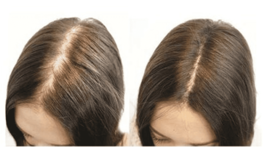 Khi chọn serum phục hồi tóc, cần chọn sản phẩm đến từ nguồn gốc uy tín, thành phần thiên nhiên lành tính để tránh kích ứng da đầu