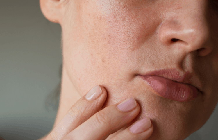 Chăm sóc da khô mùa xuân đúng cách là yếu tố then chốt giúp làn da duy trì độ ẩm tự nhiên, giảm thiểu tình trạng bong tróc, nứt nẻ