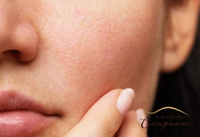 Tại Skinlab, quy trình chăm sóc bảo vệ da nhạy cảm mùa nồm được thiết kế tỉ mỉ nhằm giải quyết từng vấn đề da gặp phải.