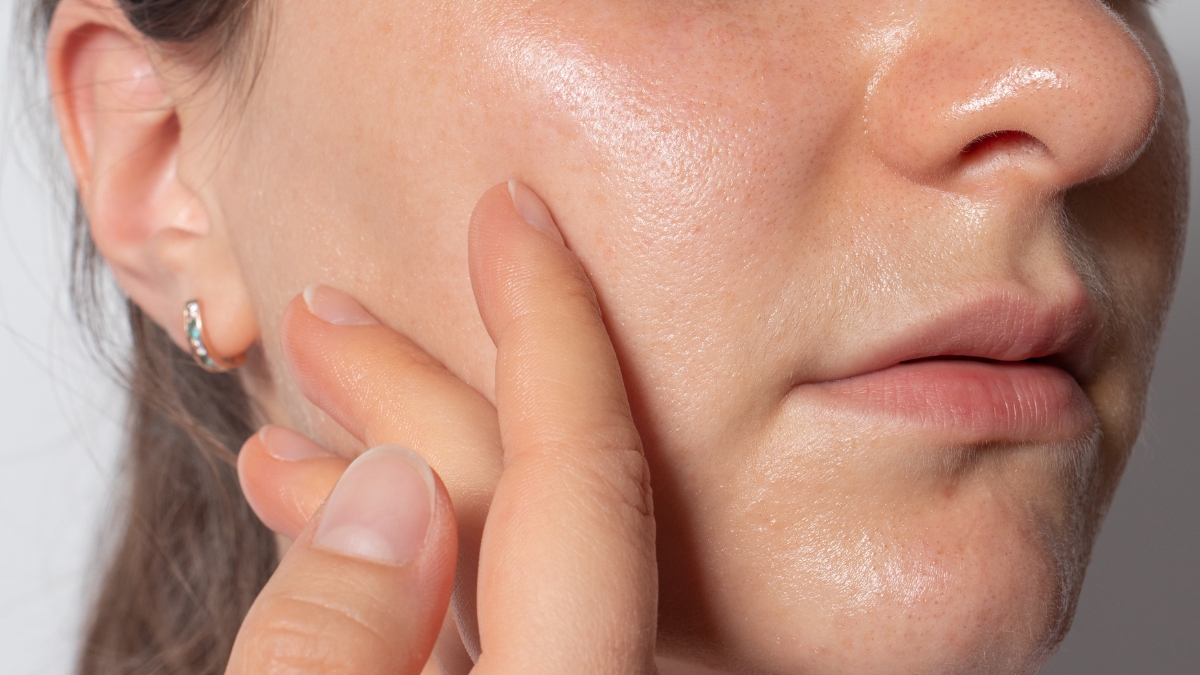 Chăm sóc da đầu mùa nồm trở thành nhu cầu cấp thiết để tránh những tổn thương như kích ứng, bong tróc hay mụn nghiêm trọng.