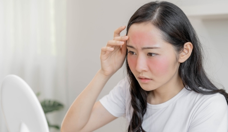 Chăm sóc hàng rào bảo vệ da mùa nồm là điều hết sức cần thiết để duy trì làn da khỏe, tránh các vấn đề về kích ứng hay nhiễm khuẩn.