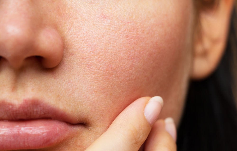 Skinlab tự hào là spa chuyên nghiệp với các dịch vụ chăm sóc da chuyên sâu, đặc biệt phù hợp với các vấn đề da xuất hiện vào mùa nồm