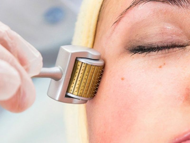 Chăm sóc làn da bằng phương pháp phi kim tại spa Quảng Ninh là một quyết định sáng suốt dành cho những ai mong muốn sở hữu vẻ đẹp tươi trẻ