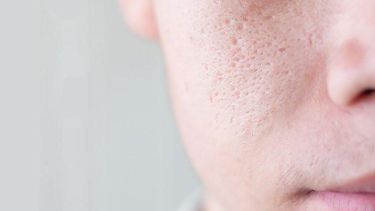 chọn một địa chỉ Spa trị sẹo rỗ Hải Phòng uy tín đóng vai trò then chốt trong việc cải thiện và phục hồi làn da hiệu quả.