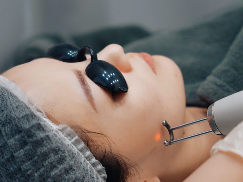 Công nghệ laser giúp tác động sâu, loại bỏ mụn hiệu quả và an toàn, đồng thời hỗ trợ tái tạo làn da mịn màng hơn.