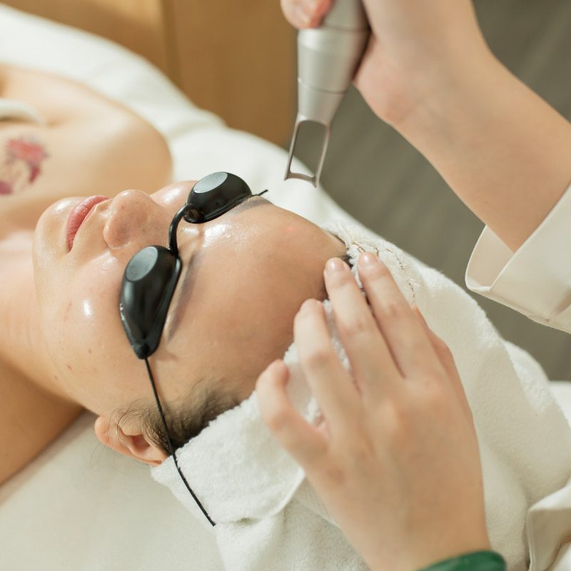 Để đạt được hiệu quả tối ưu khi trị mụn bằng laser, khách hàng nên tuân thủ một số lưu ý quan trọng tại spa trị mụn bằng laser HCM