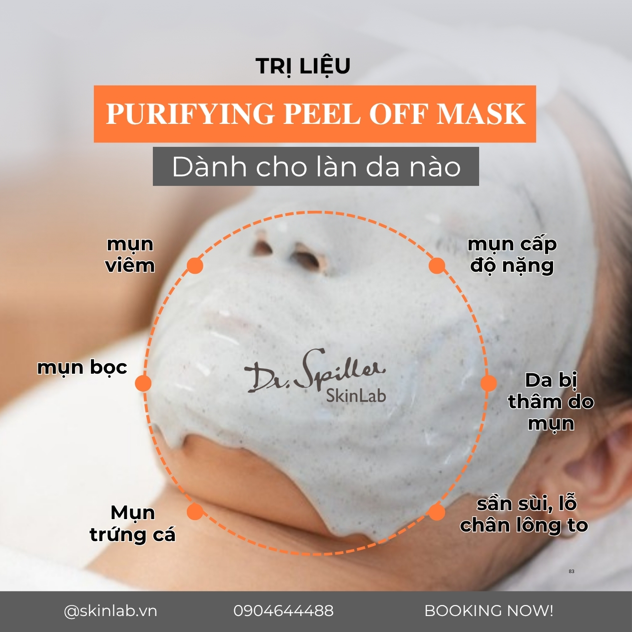 lựa chọn spa trị mụn nhanh HCM không nên dựa vào giá cả hay quảng cáo mà cần ưu tiên chất lượng và độ tin cậy.