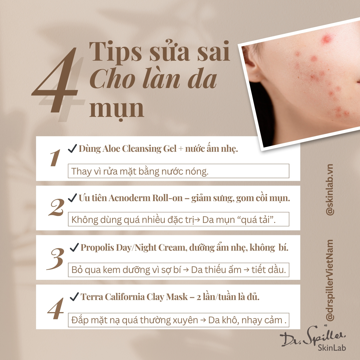 Chọn lựa spa trị mụn an toàn HCM dành cho mọi làn da