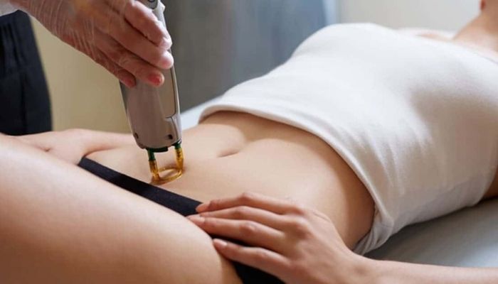 Skinlab – Địa chỉ spa triệt lông an toàn hàng đầu tại HCM