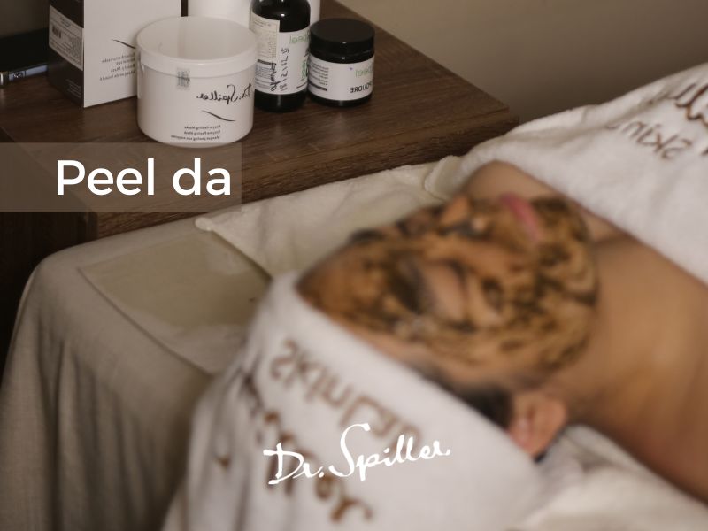 Peel da hóa học tại Skinlab – Hiệu quả đến từ quy trình chuẩn