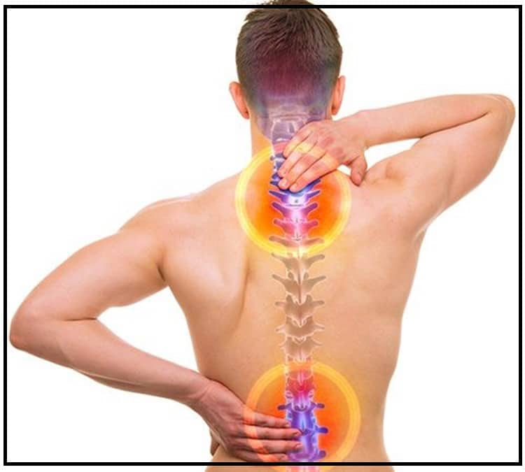 Phòng ngừa thoái hóa cột sống bằng việc duy trì thói quen sinh hoạt lành mạnh đóng vai trò thiết yếu