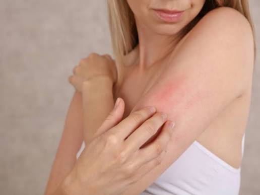 Da body bị khô ngứa là vấn đề phổ biến xảy ra ở nhiều người, gây ra không ít phiền toái trong sinh hoạt hàng ngày