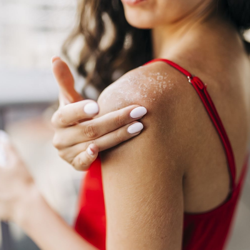 cải thiện tình trạng da body bị sần không chỉ dừng lại sau khi điều trị mà còn cần duy trì chế độ chăm sóc khoa học hàng ngày