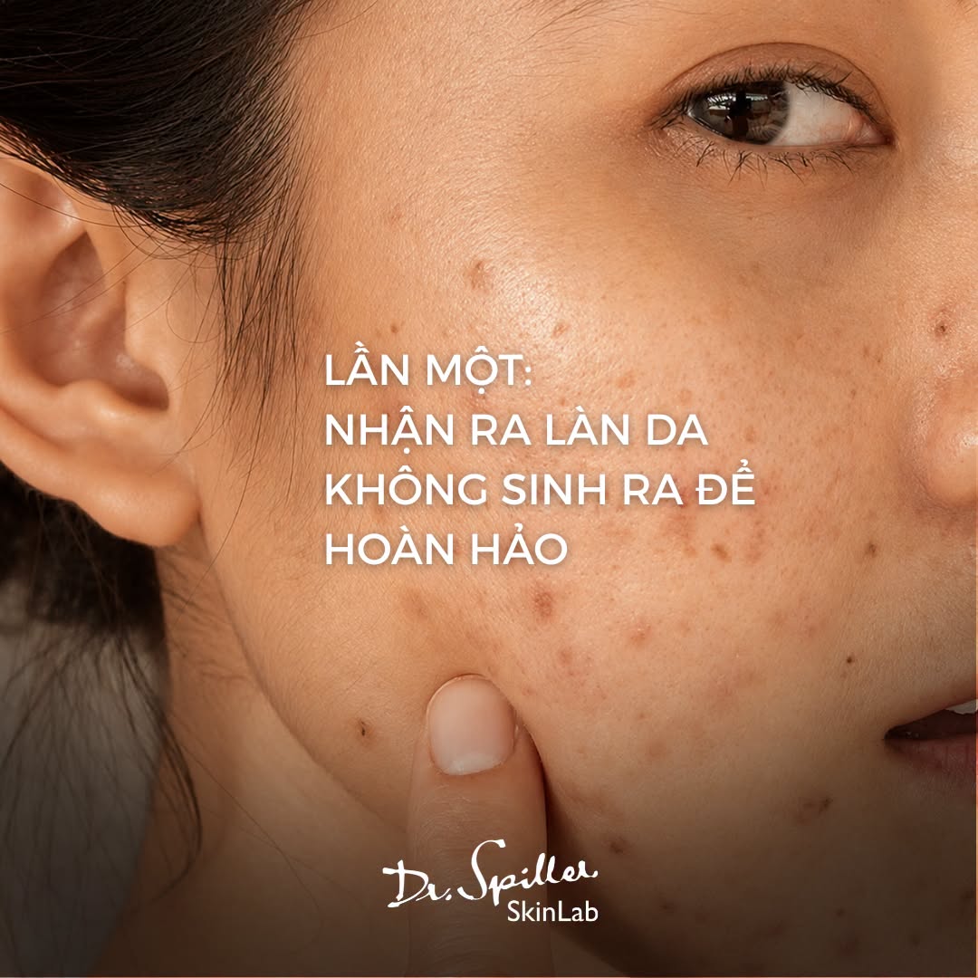 Skinlab xây dựng các liệu trình dành cho làn da mụn dựa trên tình trạng thực tế thay vì áp dụng một phương pháp cố định cho mọi khách hàng.