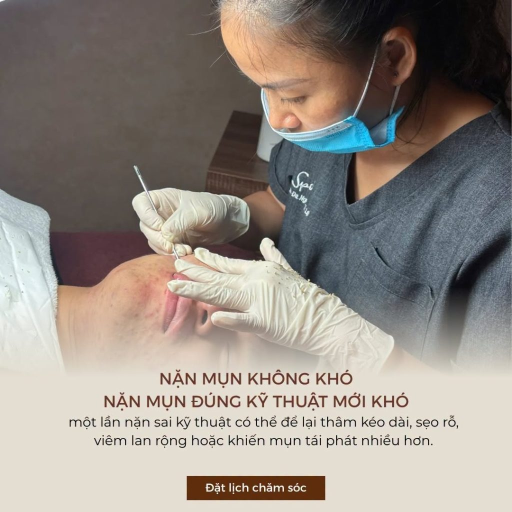 Sau khi thực hiện liệu trình, việc chăm sóc tại nhà quyết định không nhỏ đến khả năng duy trì kết quả